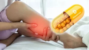 Vitamin-D-Deficiency-_V_jpg--1280x720-4g