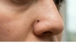 Nose-Mole-Meaning-Females_V_jpg--1280x720-4g