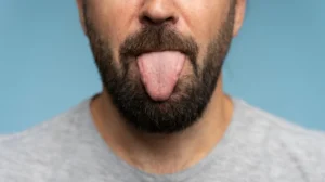cause-of-yellow-tongue
