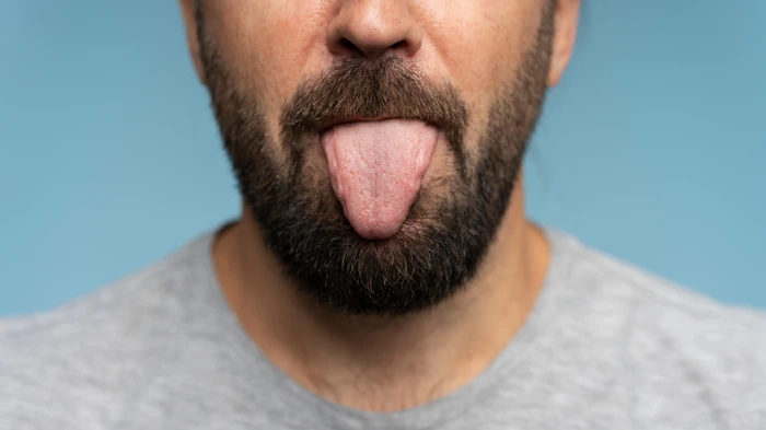 cause-of-yellow-tongue